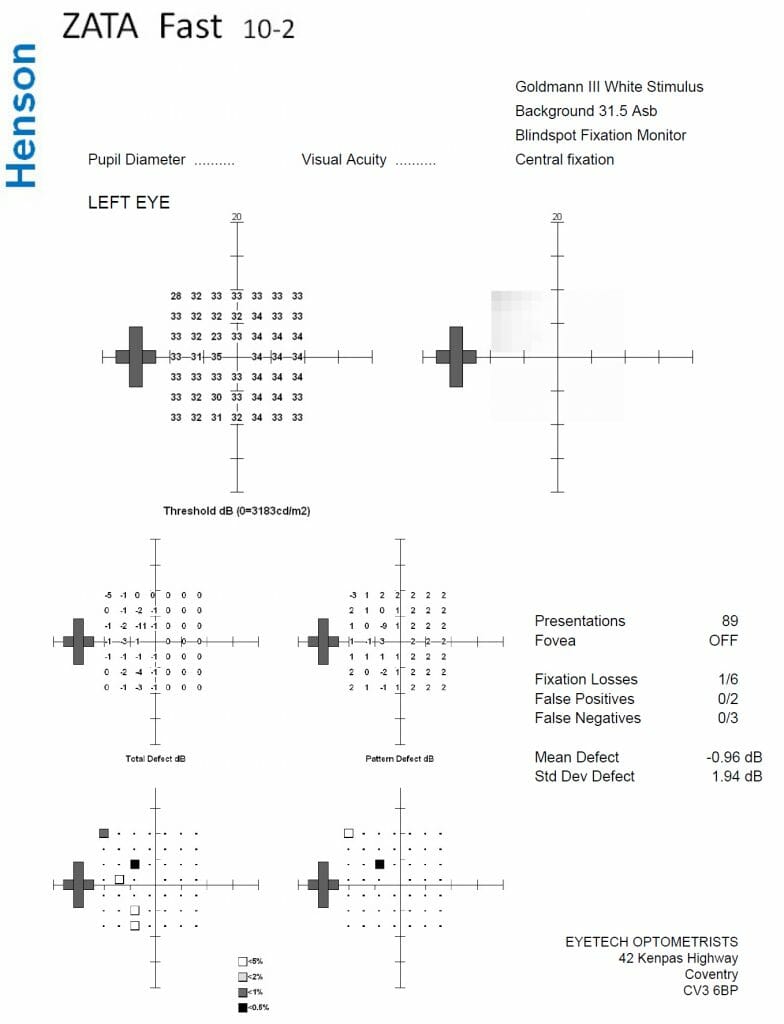 visual fields test